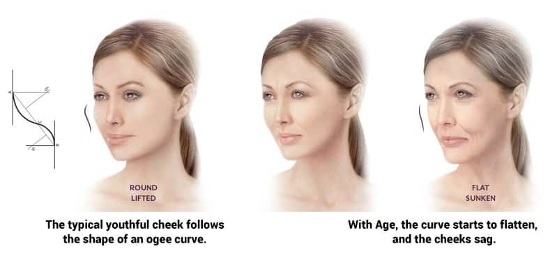 Ogee-