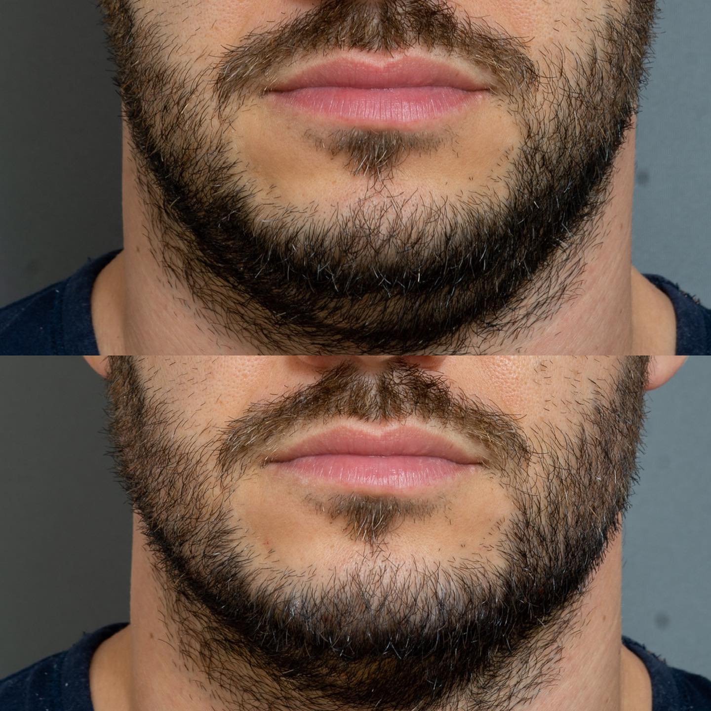 Facial Masculinity Enhancement - Javaani