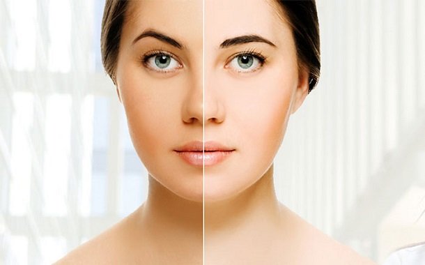 skin whitening and brightening treatment
