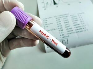 Diabetes & HbA1c Blood Testing in High Wycombe
