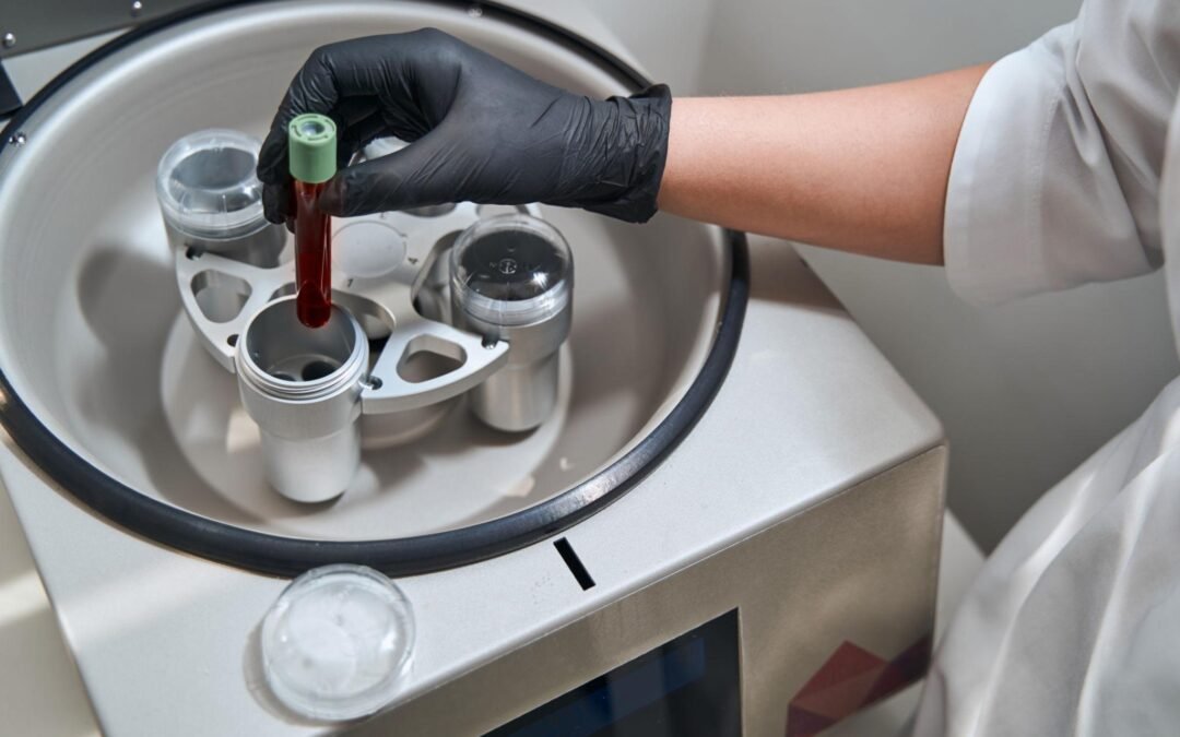 What Are Autologous Exosomes A Doctor-Led Guide to ExoSmart™ for Hair and Skin Regeneration