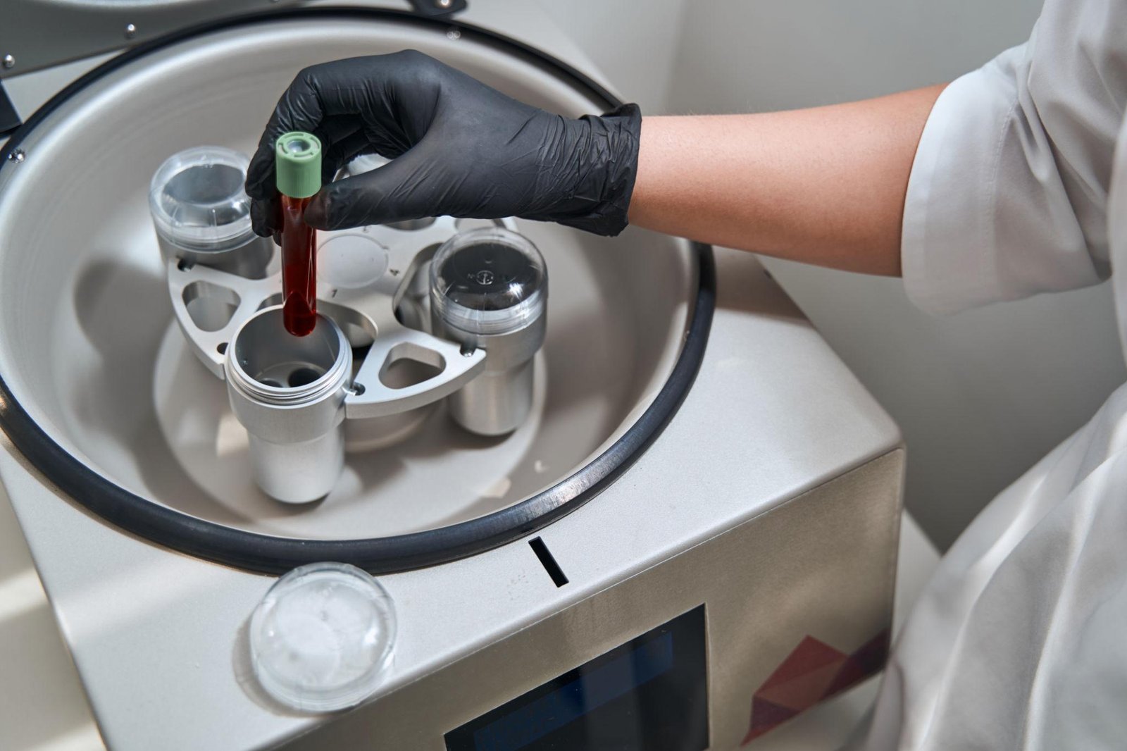 What Are Autologous Exosomes A Doctor-Led Guide to ExoSmart™ for Hair and Skin Regeneration