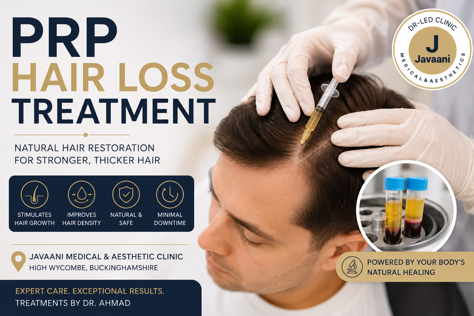 PRP Hair Loss Treatment in High Wycombe